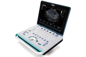 KR-E80筆記本式彩超機